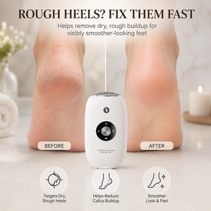 🦶Automatic Foot Pedicure Grinder-Get Smoother Feet at Home
