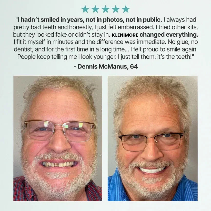 Realistic Upper & Lower Dentures - Natural-Looking Teeth Replacement
