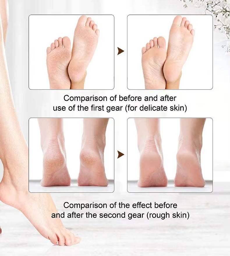 Rechargeable Electric Foot File Callus Remover with LED Display