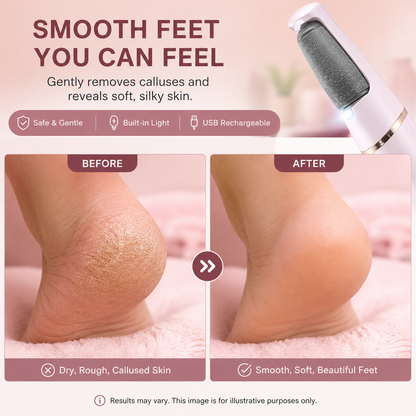 Rechargeable Electric Foot File Callus Remover with LED Display