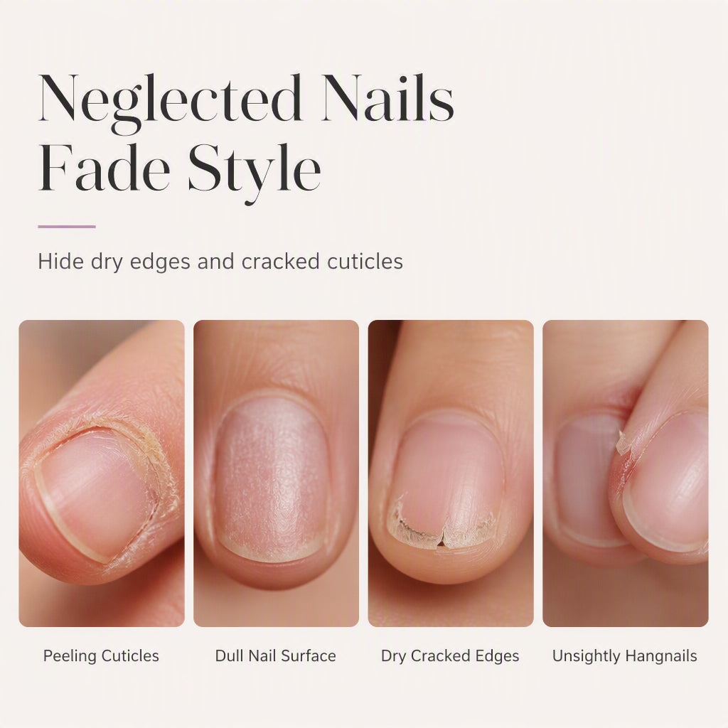 Four close-up examples of dry nail edges, peeling cuticles, dull nails and hangnails