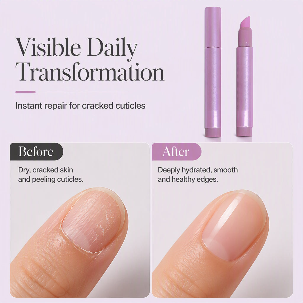 🔥Buy 3 Get 5 Free(8PCS)🔥Portable Nail Care Essence Pen – Precise Cuticle Moisturizing Treatment, Smooth Applicator Tip & Compact Travel-Friendly Design – Healthy Nails Anywhere, Anytime💅